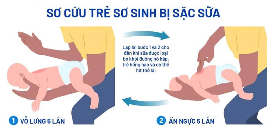 Sặc sữa ở trẻ sơ sinh: Nguyên nhân, dấu hiệu và cách phòng tránh